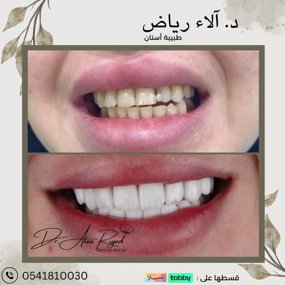 WhatsApp-Image-2025-01-15-at-13.22.56_b8c6c3a9