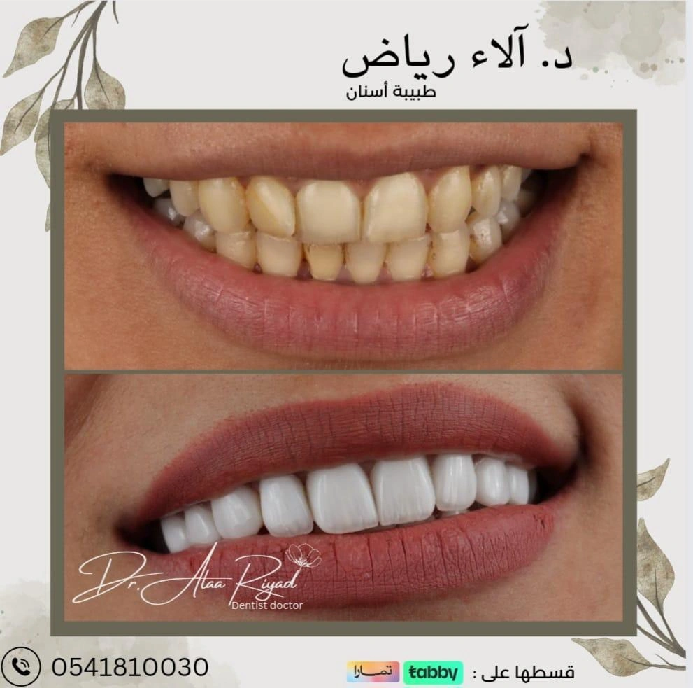 WhatsApp-Image-2025-01-15-at-13.22.58_0dff4220