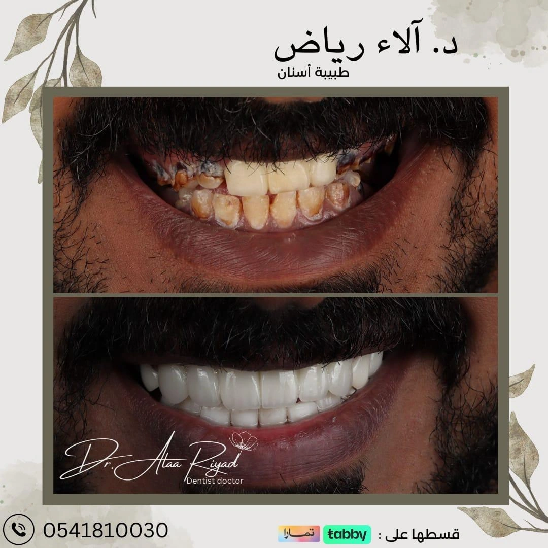 WhatsApp-Image-2025-01-15-at-13.22.58_306cd919
